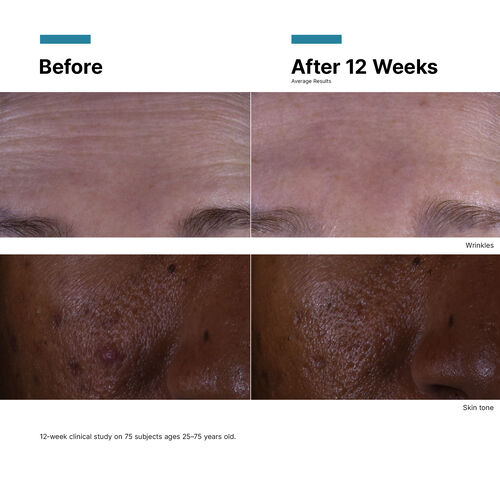 C E Ferulic with 15% L-Ascorbic Acid - Prevent | L'Or&eacute;al Dermatological Beauty Partner Shop
