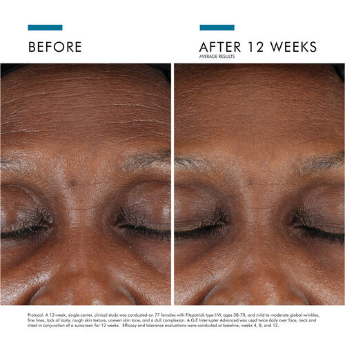 A.G.E. Interrupter Advanced - SkinCeuticals | L'Or&eacute;al Dermatological Beauty Partner Shop