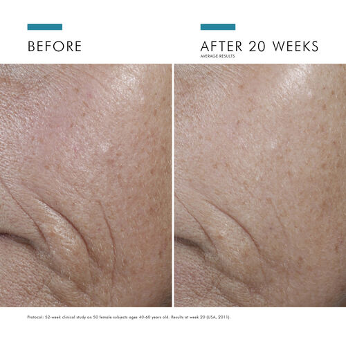 C E Ferulic with 15% L-Ascorbic Acid - Pr&eacute;venir | L'Or&eacute;al Dermatological Beauty Partner Shop