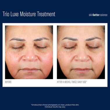 Trio Luxe Moisture Treatment - Latest Launches | L'Oréal Dermatological Beauty Partner Shop