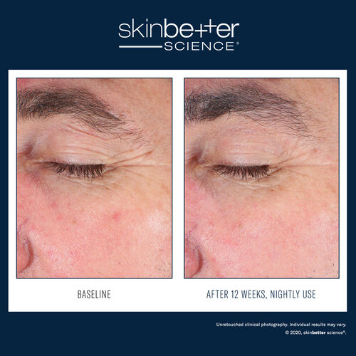 EyeMax AlphaRet Overnight Cream - Best Sellers | L'Or&eacute;al Dermatological Beauty Partner Shop