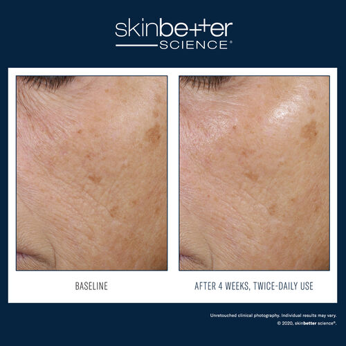Trio Rebalancing Moisture Treatment - Best Sellers | L'Or&eacute;al Dermatological Beauty Partner Shop