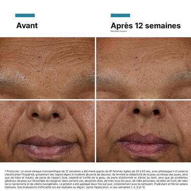 HA Intensifier Multi-Glycan - ACHETER PAR MARQUE | L'Oréal Dermatological Beauty Partner Shop