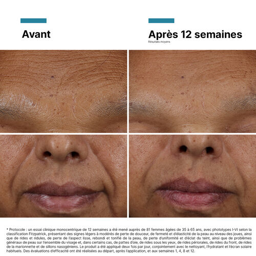 HA Intensifier Multi-Glycan - ACHETER PAR MARQUE | L'Or&eacute;al Dermatological Beauty Partner Shop