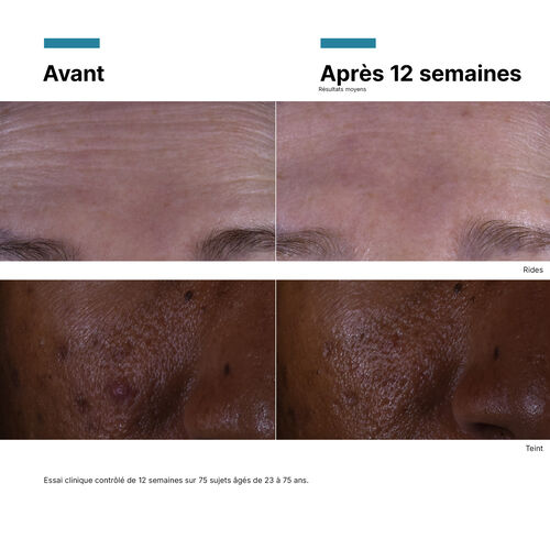 C E Ferulic with 15% L-Ascorbic Acid - Pr&eacute;venir | L'Or&eacute;al Dermatological Beauty Partner Shop
