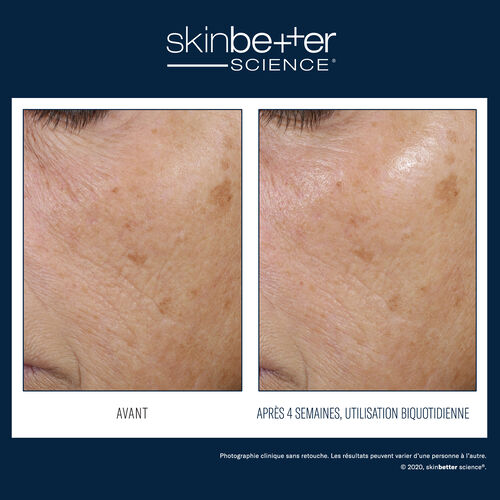 Trio Soin hydratant r&eacute;&eacute;quilibrant - skinbetter science | L'Or&eacute;al Dermatological Beauty Partner Shop