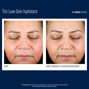 Trio Luxe Soin hydratant - Nouveautés | L'Oréal Dermatological Beauty Partner Shop